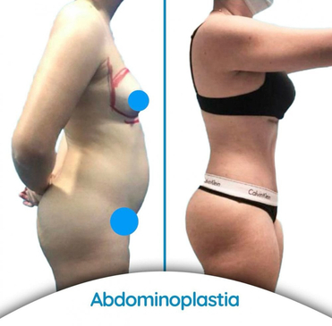 Slider image (7) Dr. Alvaro Uribe Clinic in Cartagena